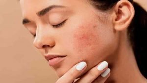 Cure For Skin Cancer Finally Here???