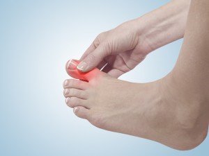How to Control Gout