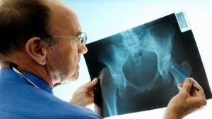 What is Ortho