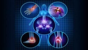 How to Manage Arthritis Pain Naturally