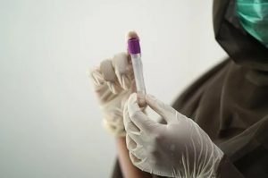 Do you the about the Life Insurance Medical Exam? If not, Grab the knowledge now!!