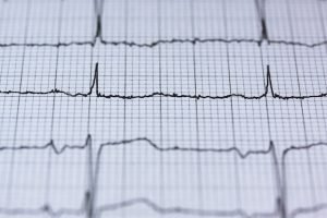 What is Cardiac Arrest and its Reasons?